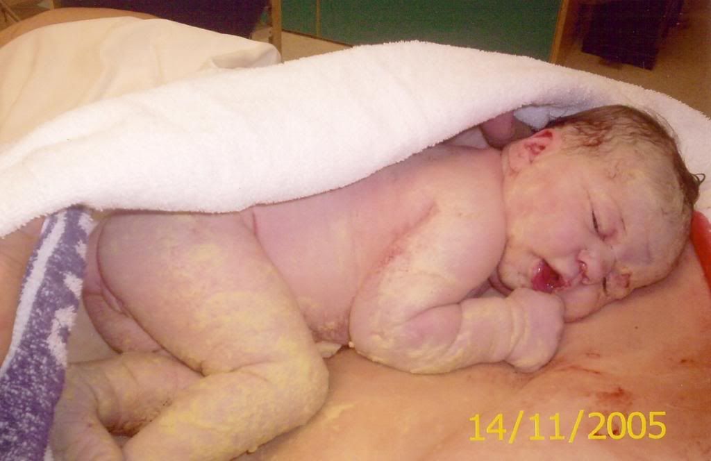 Baby Vernix