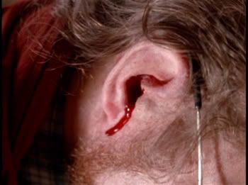 11-ear-bleeding1.jpg